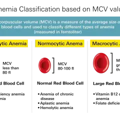 Porównanie wielkości erytrocytów w anemii mikrocytarnej, normocytarnej i makrocytarnej. MCV to wskaźnik pomocny w diagnostyce, choć odczyn Coombsa jest innym badaniem.