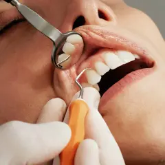 Dentysta używa narzędzi do ekstrakcji zęba. Widoczne są usta pacjenta, lustro dentystyczne i narzędzie.