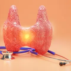 Model tarczycy z widocznym ogniskiem zapalnym, symbolizującym raka rdzeniastego tarczycy. Obok leży stetoskop.
