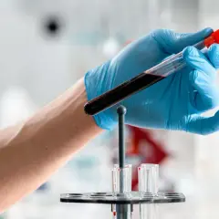 Ręka w niebieskiej rękawiczce trzyma probówkę z ciemną cieczą, prawdopodobnie próbkę krwi do badań. W tle widać stojak z innymi probówkami. To ważny etap w procesie diagnostycznym, być może związany z analizą hbc.