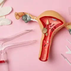 Model narządu rodnego z widocznymi zmianami, narzędzia ginekologiczne i rękawiczki. Wczesne wykrycie raka endometrium objawy są kluczowe.