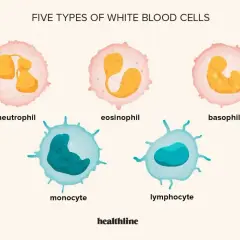 Pięć typów białych krwinek: neutrofil, eozynofil, bazofil, monocyt, limfocyt. Zwiększona liczba białych krwinek to leukocytoza.