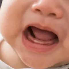 Ząbkowanie: Jak wyglądają dziąsła niemowlaka? Zdjęcia i porady