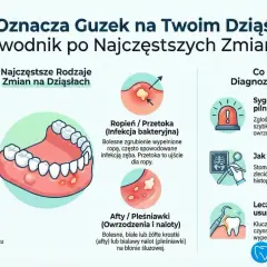 Ilustracja przedstawia ropień, który może być objawem przetoki zębowej. Widoczne są różne zmiany na dziąsłach i zębach.