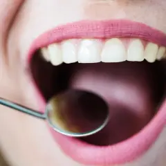 Uśmiech z różowymi ustami i lśniącymi zębami, podczas gdy dentystyczne lusterko bada zęby dziewiątki.