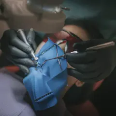 Precyzyjne leczenie kanałowe pod mikroskopem. Dentysta w rękawiczkach używa narzędzi do zabiegu.