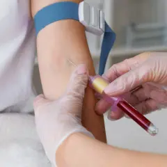 Pobieranie krwi do badań diagnostycznych, które mogą pomóc wykryć raka szpiku kostnego.