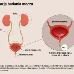 Schemat dróg moczowych z zaznaczonymi nerkami, moczowodami, pęcherzem i cewką. Widoczne bakterie w pobliżu ujścia cewki, sugerujące bakterie w moczu.