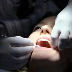 Uśmiechnięta pacjentka u dentysty, który używa narzędzi i pasty devipasta do wybielania zębów.