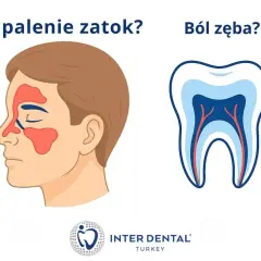 Zapalenie zatok czy tragiczny ból zęba? Ilustracja porównuje objawy zapalenia zatok z budową zęba.