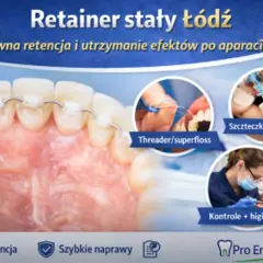 Aparat stały na zębach, pokazujący jak dbać o higienę z retainerem stałym.