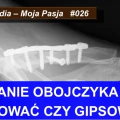 Złamanie kości: Ortopeda czy chirurg? Kto naprawdę Ci pomoże?