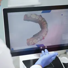 Wycisk zębów: Bezbolesne skanowanie 3D czy tradycyjna masa?