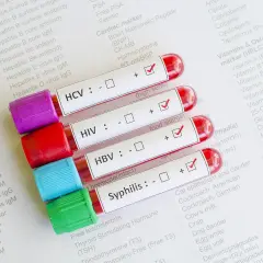 Próbki krwi do badań na choroby weneryczne: HCV, HIV, HBV, kiła. Wyniki testów na papierze.