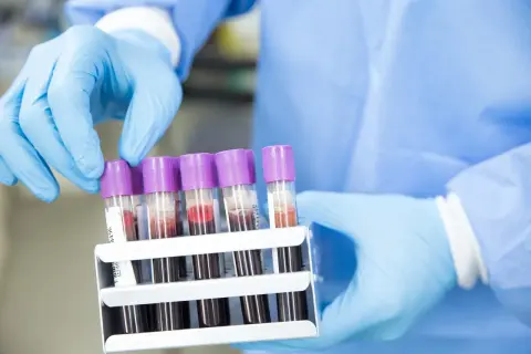 Ręce w niebieskich rękawiczkach trzymają stojak z probówkami krwi. Anty TG cena badań jest kluczowa dla diagnostyki.