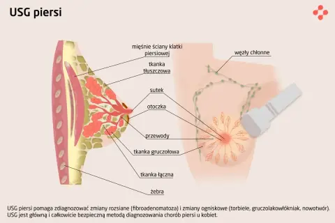 Schemat USG piersi: badanie pomaga wykryć zmiany, kiedy są małe. Pokazuje tkanki, przewody i węzły chłonne.