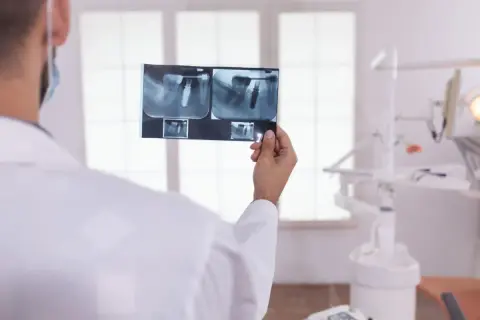 Dentysta analizuje RTG zęba z implantem, zastanawiając się, ile kanałów ma 5.