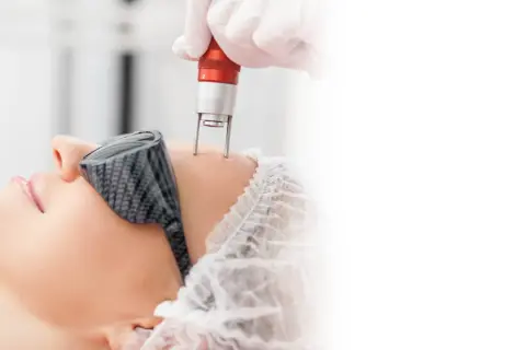 Zabieg laserowy na twarz w klinice dermatologii estetycznej.