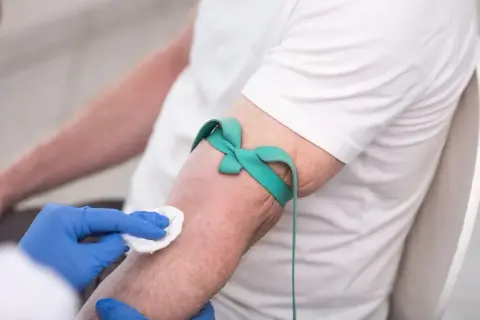 Przygotowanie do pobrania krwi na badanie HBs. Ręka pacjenta z opaską uciskową, pielęgniarka dezynfekuje skórę.