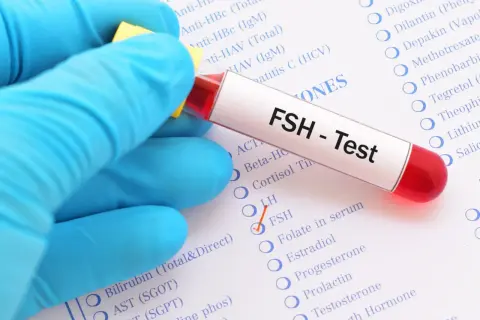 Rękawiczka w niebieskiej rękawiczce trzyma probówkę z napisem "FSH - Test". Obok zaznaczono opcję FSH na liście badań.