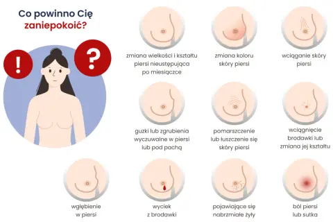 Grafika pokazuje objawy, które mogą świadczyć o nowotworze piersi: zmiany wielkości, koloru, wciąganie skóry, guzki, wyciek z brodawki, ból.