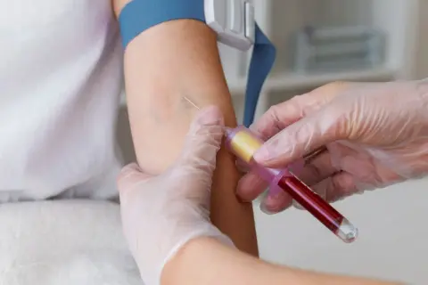 Pobieranie krwi do badań diagnostycznych, które mogą pomóc wykryć raka szpiku kostnego.