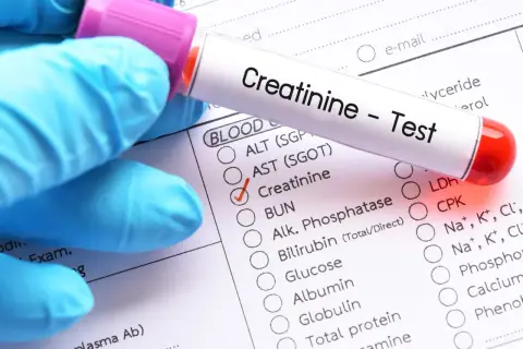 Rękawiczka w niebieskiej rękawiczce trzyma probówkę z oznaczeniem "Creatinine - Test". Obok zaznaczono badanie kreatyniny, co sugeruje jego cenę.