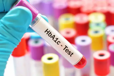 Rękawiczka trzyma probówkę z oznaczeniem HbA1c - Test. Tło to wiele kolorowych probówek. Sprawdź, jaka jest hemoglobina glikowana cena.