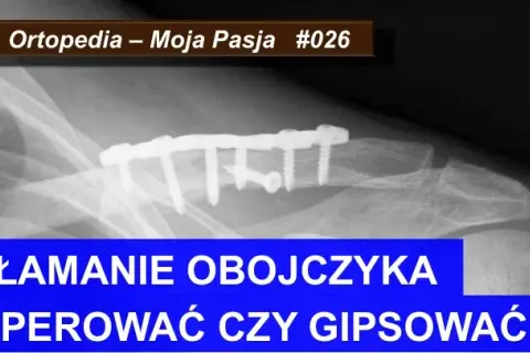 Złamanie kości: Ortopeda czy chirurg? Kto naprawdę Ci pomoże?