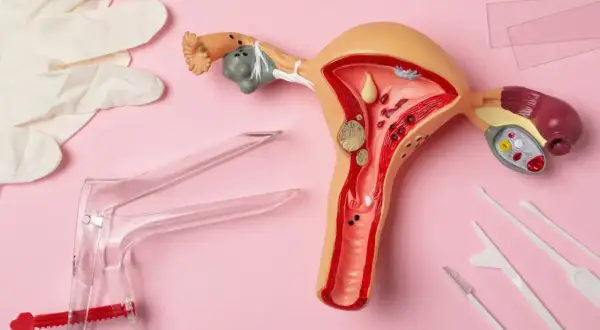 Model narządu rodnego z widocznymi zmianami, narzędzia ginekologiczne i rękawiczki. Wczesne wykrycie raka endometrium objawy są kluczowe.