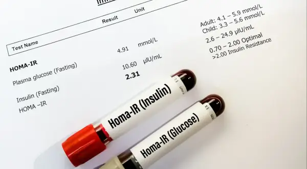 Wyniki badań immunologicznych, w tym wskaźnik HOMA-IR, wraz z probówkami Homa-IR (Insulin) i Homa-IR (Glucose).