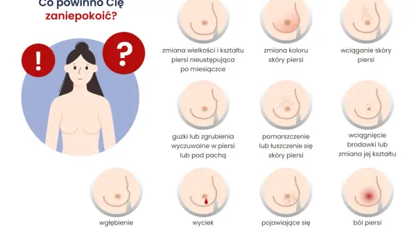 Grafika pokazuje objawy, które mogą świadczyć o nowotworze piersi: zmiany wielkości, koloru, wciąganie skóry, guzki, wyciek z brodawki, ból.