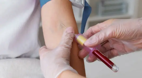 Pobieranie krwi do badań diagnostycznych, które mogą pomóc wykryć raka szpiku kostnego.