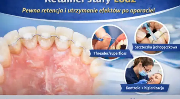 Aparat stały na zębach, pokazujący jak dbać o higienę z retainerem stałym.