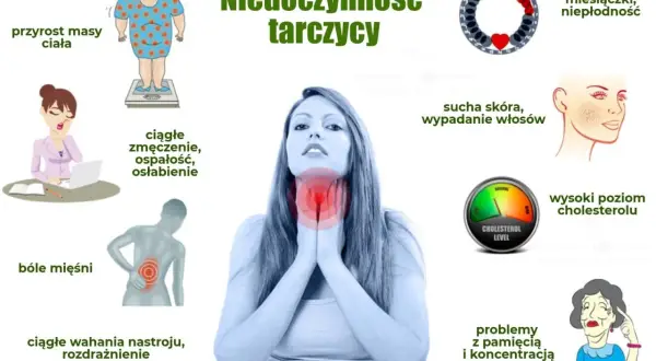 Objawy niedoczynności tarczycy: przyrost masy ciała, zmęczenie, bóle mięśni, wahania nastroju, sucha skóra, wypadanie włosów, problemy z pamięcią.