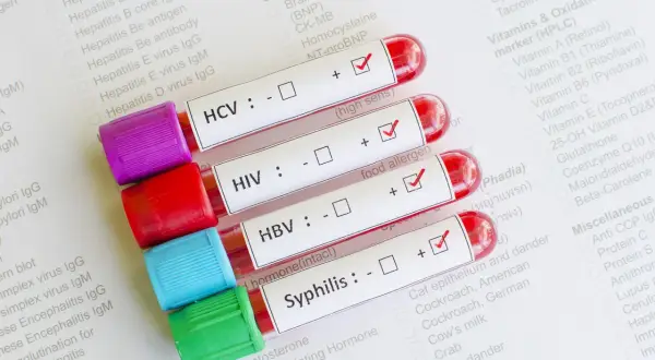 Próbki krwi do badań na choroby weneryczne: HCV, HIV, HBV, kiła. Wyniki testów na papierze.