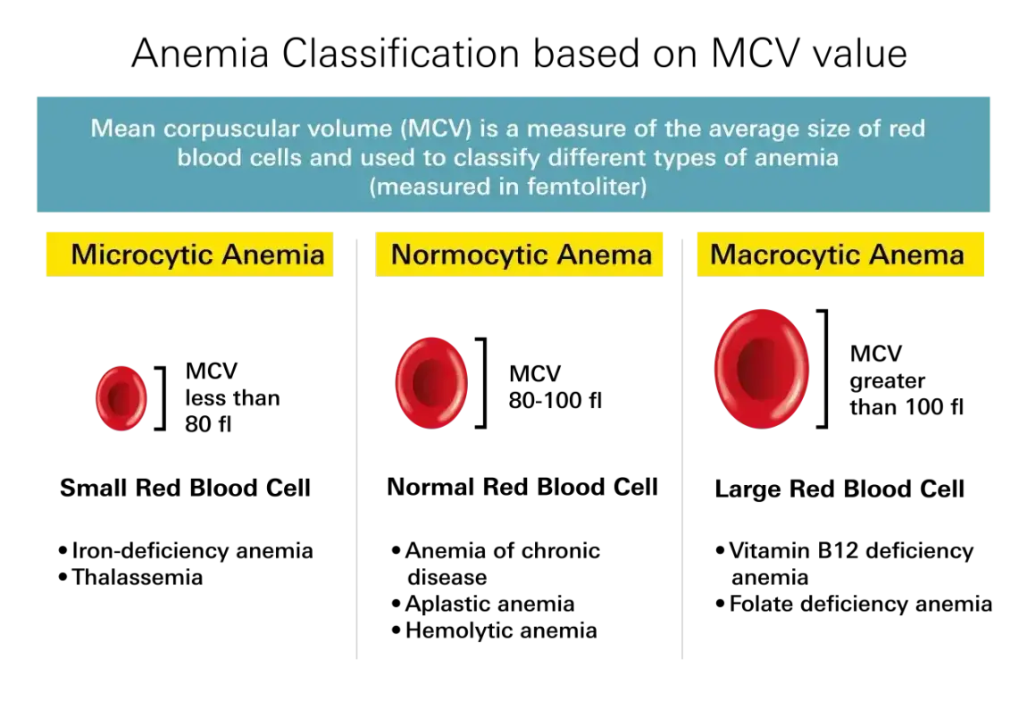 Porównanie wielkości erytrocytów w anemii mikrocytarnej, normocytarnej i makrocytarnej. MCV to wskaźnik pomocny w diagnostyce, choć odczyn Coombsa jest innym badaniem.