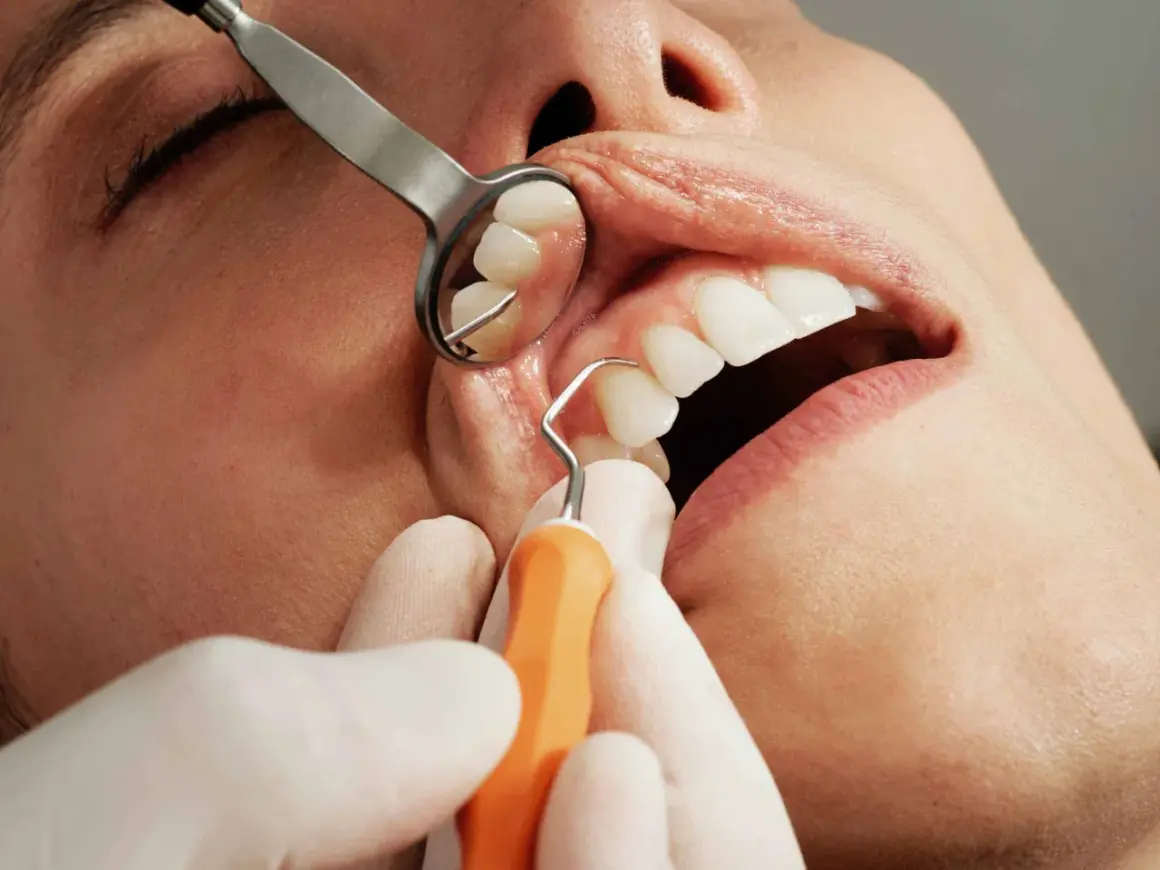 Dentysta używa narzędzi do ekstrakcji zęba. Widoczne są usta pacjenta, lustro dentystyczne i narzędzie.