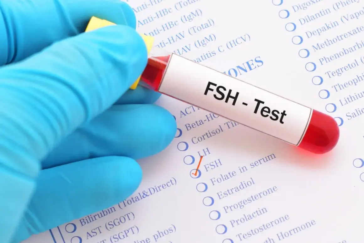 Rękawiczka w niebieskiej rękawiczce trzyma probówkę z napisem "FSH - Test". Obok zaznaczono opcję FSH na liście badań.