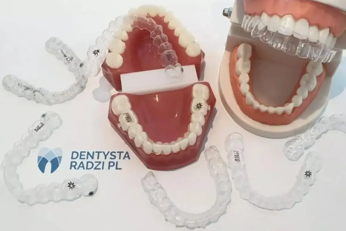 Koszt aparatu ortodontycznego w Polsce: Wszystkie wydatki, raty, NFZ