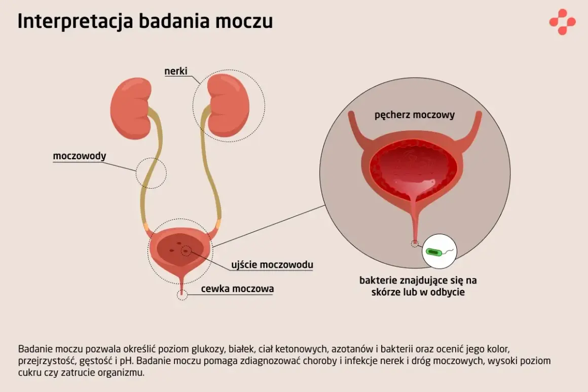 Schemat dróg moczowych z zaznaczonymi nerkami, moczowodami, pęcherzem i cewką. Widoczne bakterie w pobliżu ujścia cewki, sugerujące bakterie w moczu.