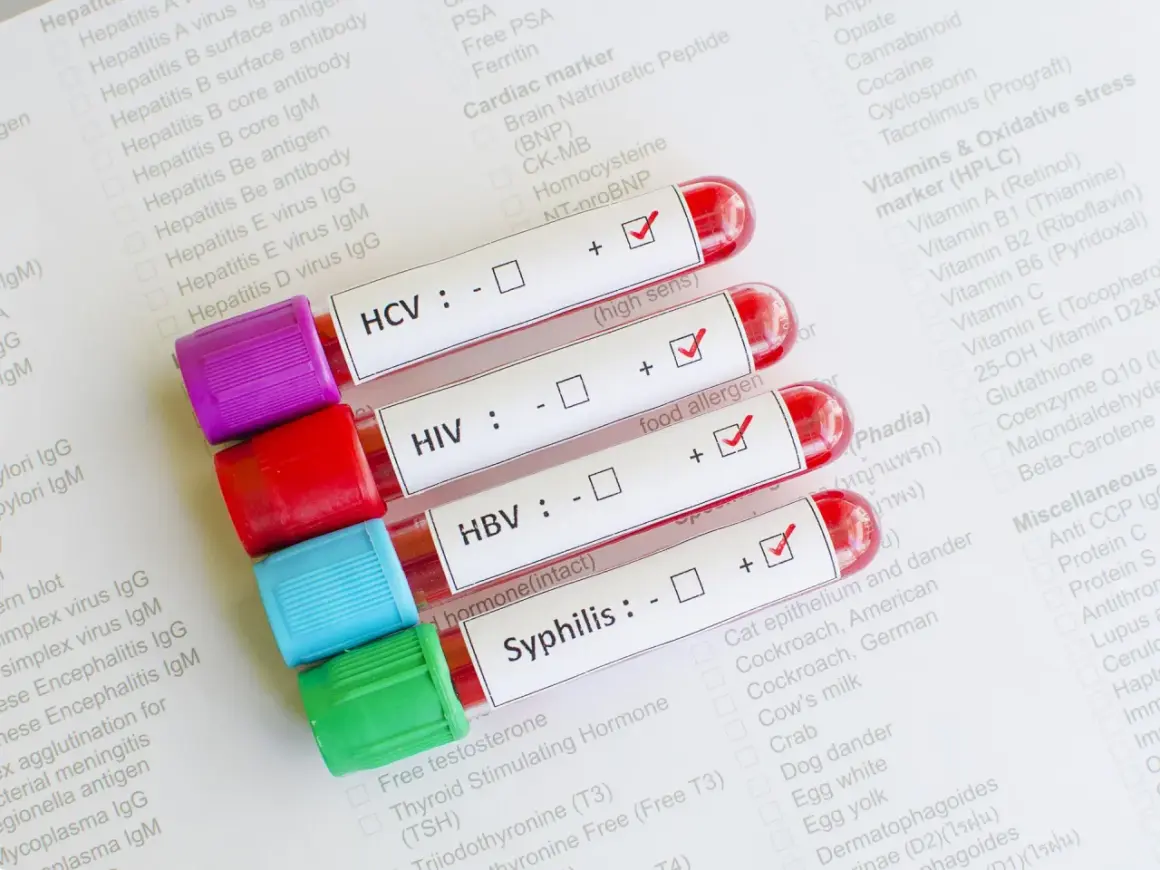 Próbki krwi do badań na choroby weneryczne: HCV, HIV, HBV, kiła. Wyniki testów na papierze.