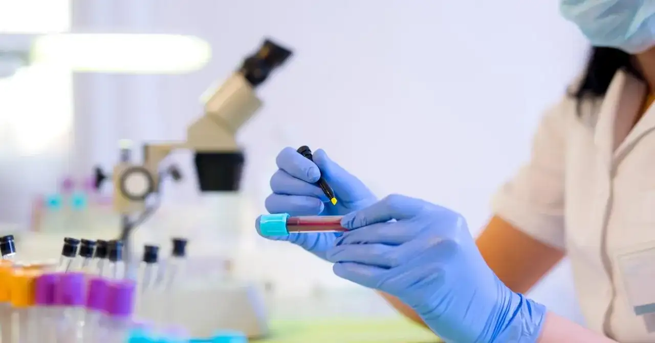 Ile kosztuje morfologia krwi? Ceny, NFZ i przygotowanie