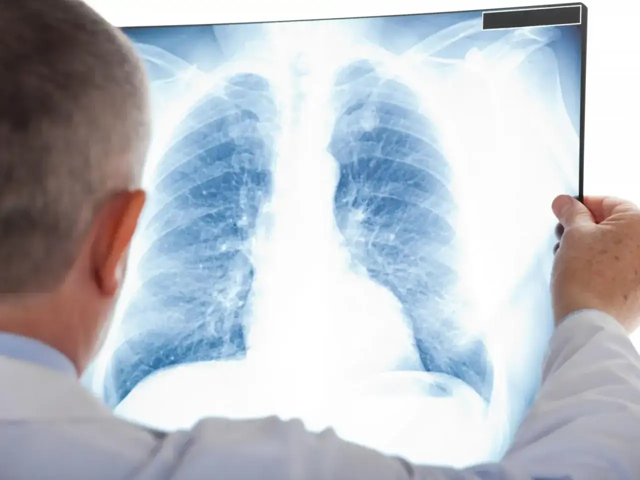 Guzek w płucu - co oznacza i kiedy wymaga pilnej diagnostyki?