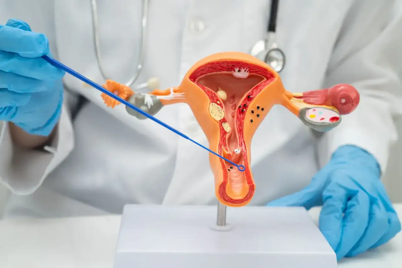 Rak pochwy - jakie objawy wymagają diagnostyki?