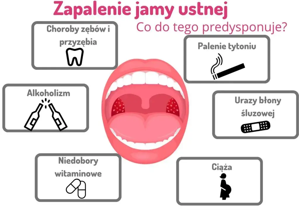 różne rodzaje zapalenia jamy ustnej objawy wizualne