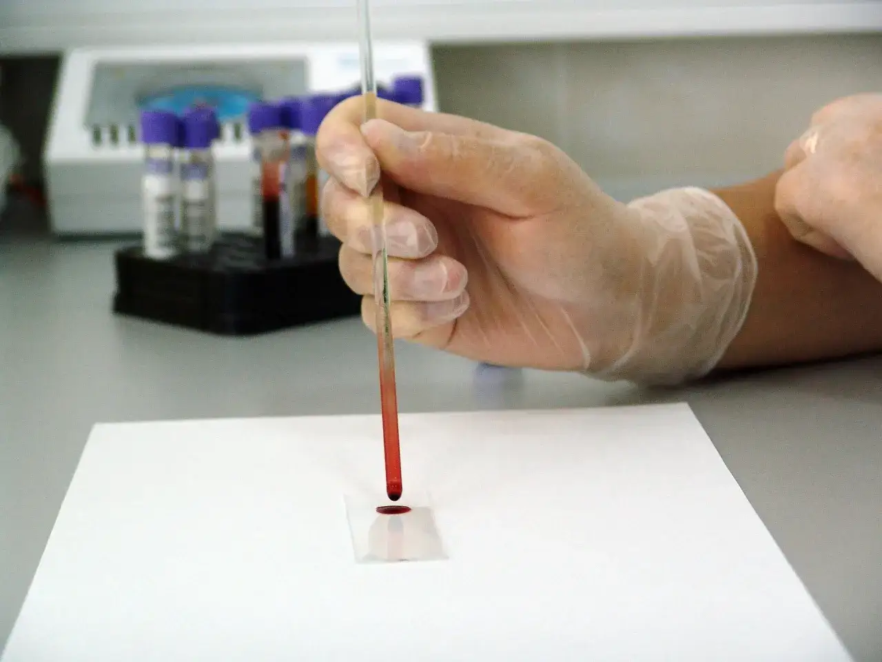 Ręka w rękawiczce pobiera próbkę krwi do badania. Analiza hemoglobiny glikowanej, cena tego badania jest kluczowa dla diabetyków.