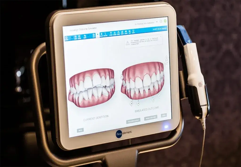 skaner wewnątrzustny stomatologia 3D