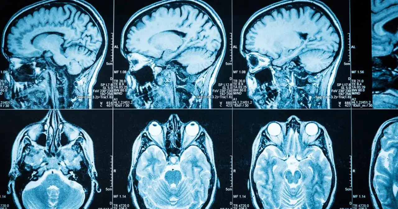 Przekroje mózgu, pokazujące jego strukturę. Badanie może pomóc w diagnostyce guzy mózgu u dzieci.