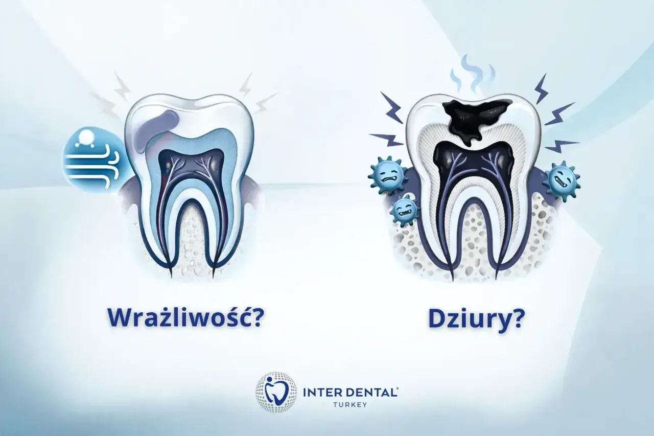Wrażliwy ząb przy dotyku? Zobacz, jak próchnica niszczy zęby, powodując ból.